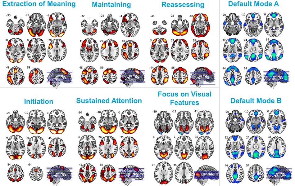 A set of brain scans using fMRI