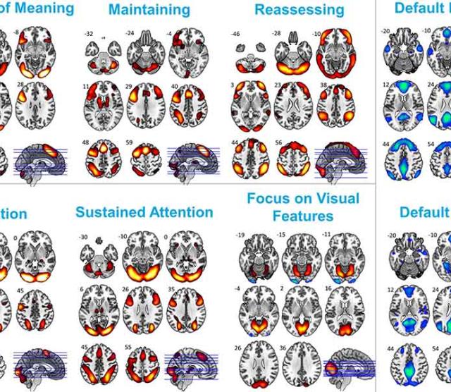 A set of brain scans using fMRI
